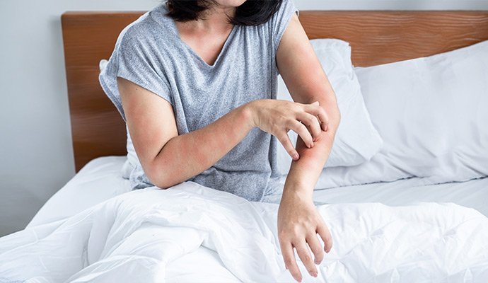 Woman scratching her arm